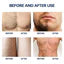 Glame Hair Removal Spray for Men and Women